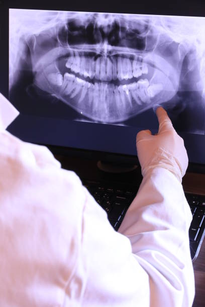 Best Emergency Treatment for Toothache in La Selva Beach, CA
